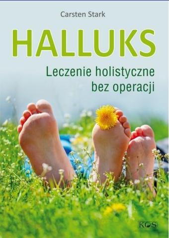 Halluks. Leczenie holistyczne bez operacji