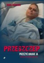 Przeszczep