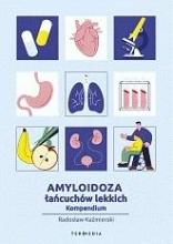 Amyloidoza łańcuchów lekkich. Kompendium