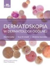 Dermatoskopia w dermatologii ogólnej